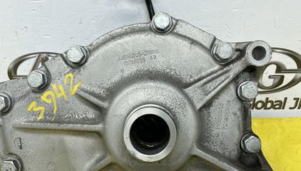 Редуктор передний BMW X5 E70 N55B30A 31507594314 5 ракурс