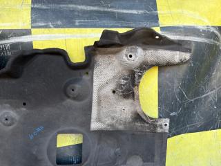 Защита BMW X1 E84 N46B20B 51752990573, 51164310 3 ракурс