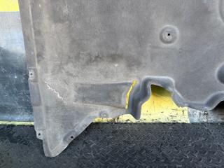 Защита BMW X1 E84 N46B20B 51752990573, 51164310 4 ракурс